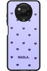 NAGLA - Xiaomi Poco X3 NFC