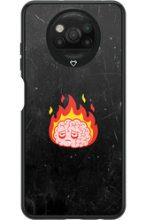 My brain - Xiaomi Poco X3 NFC