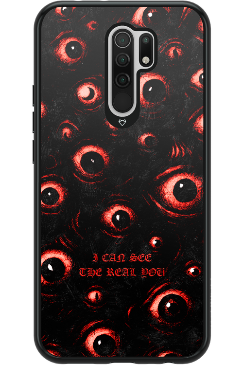 The Watchers - Xiaomi Redmi 9