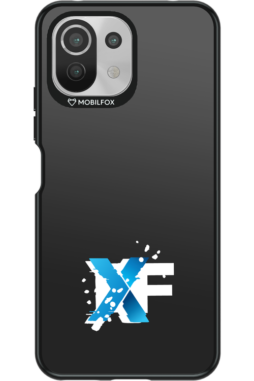 Impact Core - Xiaomi Mi 11 Lite (2021)