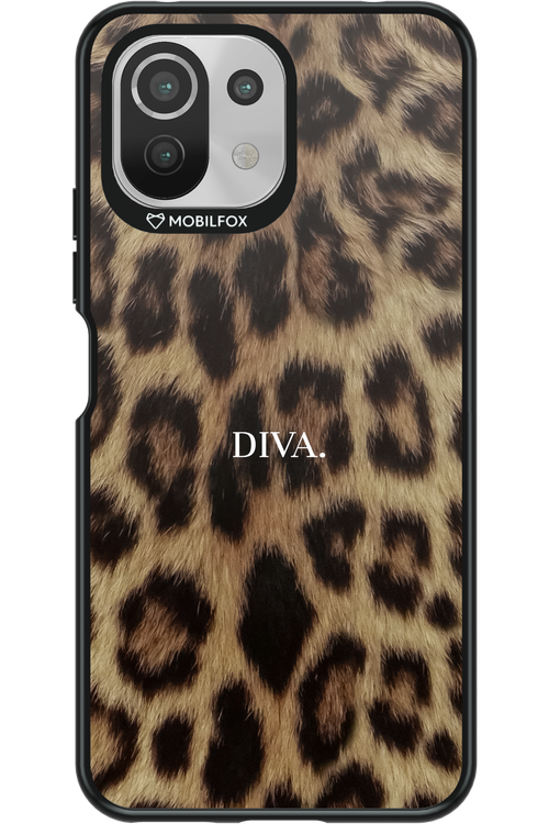 Diva - Xiaomi Mi 11 Lite (2021)