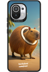 Burbaloni campioni - Xiaomi Mi 11 5G