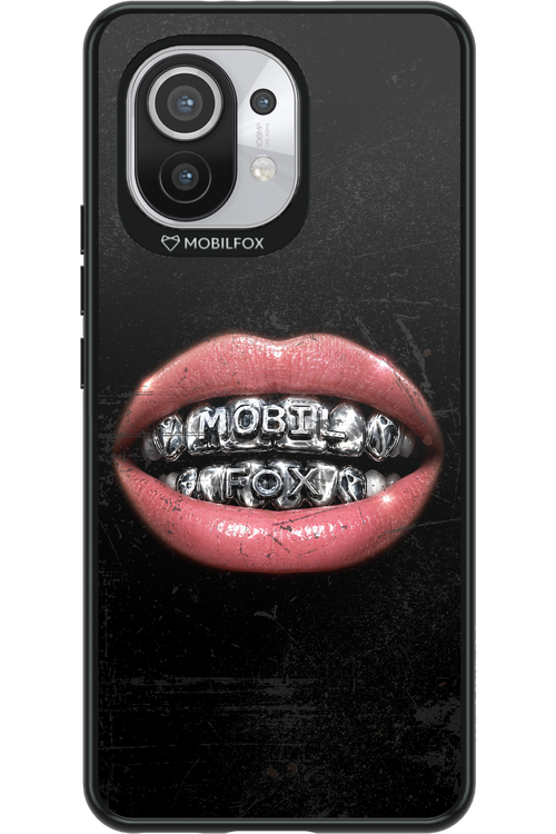 MOBILFOX GRILL 2.0 - Xiaomi Mi 11 5G