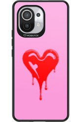 Heart Pink - Xiaomi Mi 11 5G