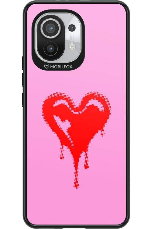 Heart Pink - Xiaomi Mi 11 5G