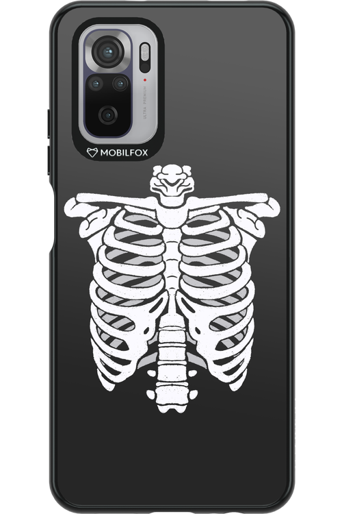 SKELETON - Xiaomi Redmi Note 10