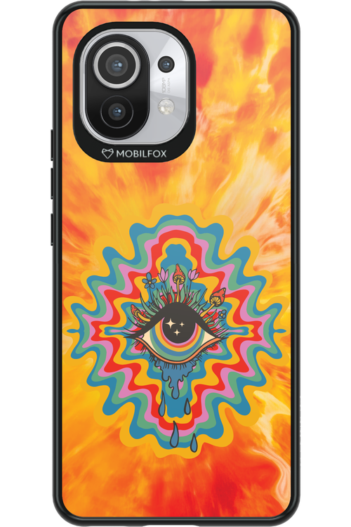 ThirdEye 2.0 - Xiaomi Mi 11 5G