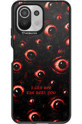 The Watchers - Xiaomi Mi 11 Lite (2021)