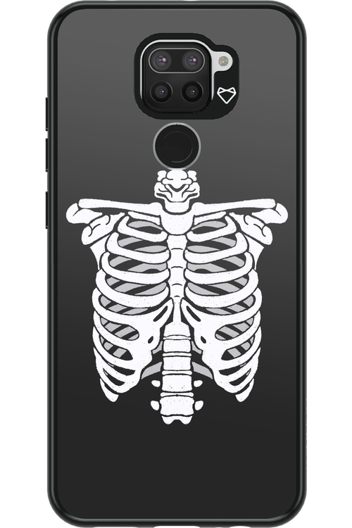 SKELETON - Xiaomi Redmi Note 9