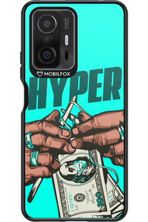 KNIT - Xiaomi Mi 11T