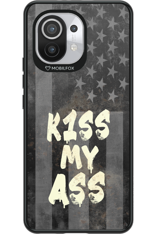 KISS II 2.0 - Xiaomi Mi 11 5G