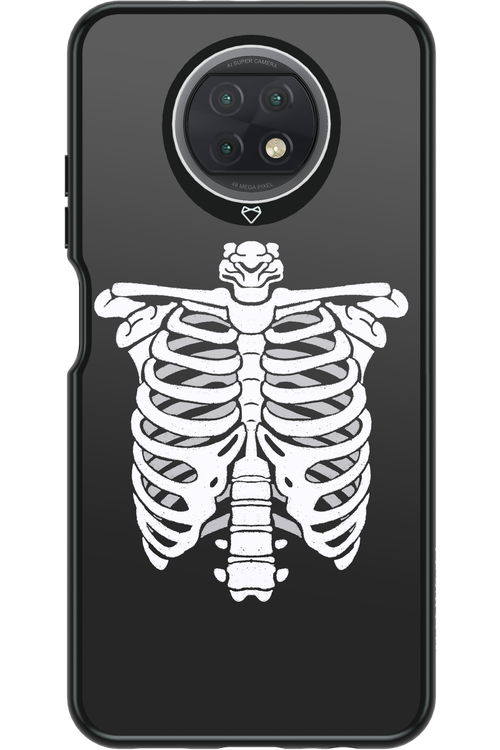 SKELETON - Xiaomi Redmi Note 9T 5G