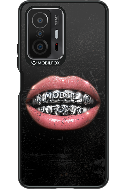 MOBILFOX GRILL 2.0 - Xiaomi Mi 11T Pro
