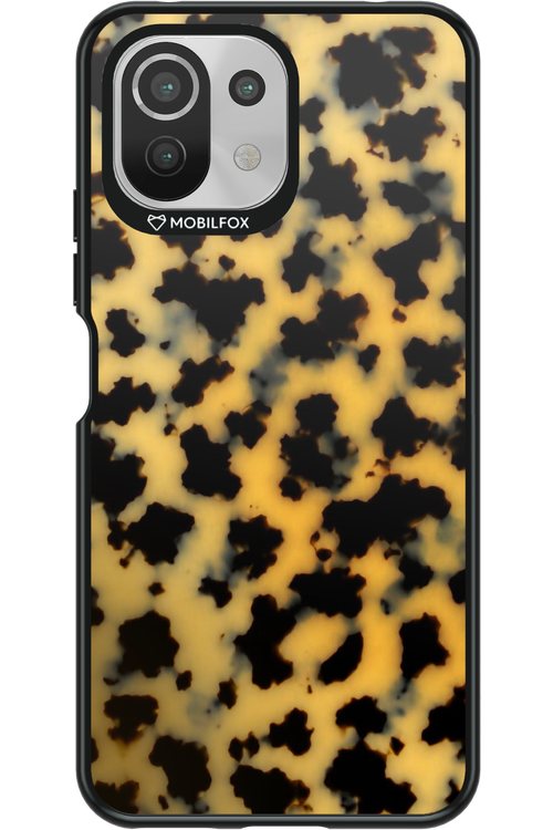 Tortoiseshell 2.0 - Xiaomi Mi 11 Lite (2021)