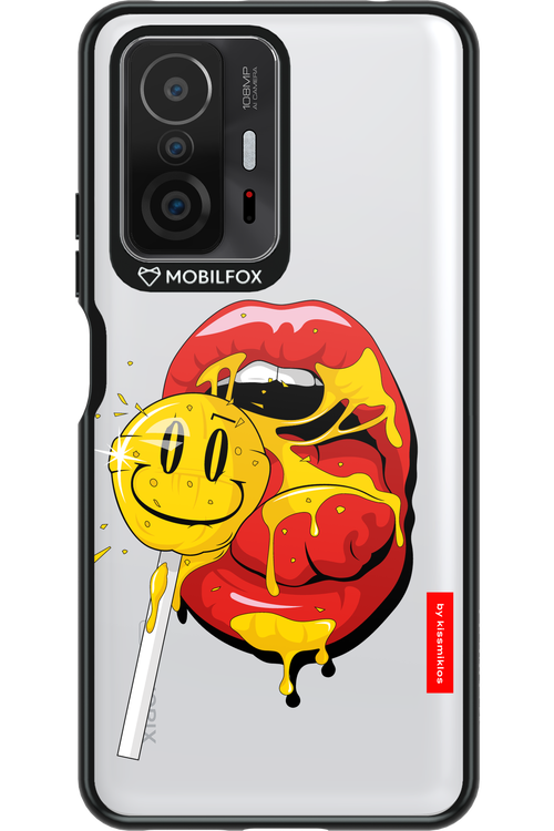 Lolli Kiss 2.0 - Xiaomi Mi 11T