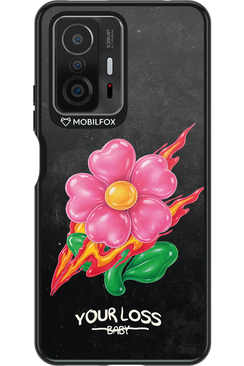 Your Loss 2.0 - Xiaomi Mi 11T