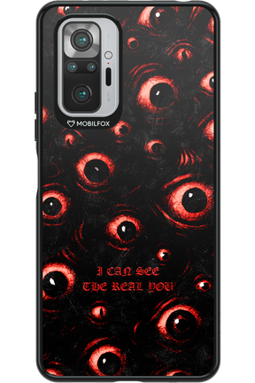 The Watchers - Xiaomi Redmi Note 10S