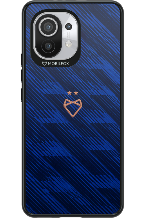 Franta 2.0 x Mobilfox 2.0 - Xiaomi Mi 11 5G