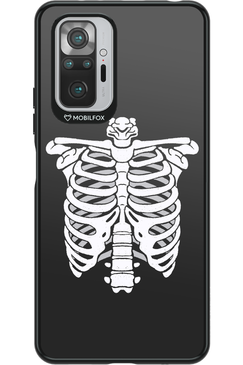 SKELETON - Xiaomi Redmi Note 10S