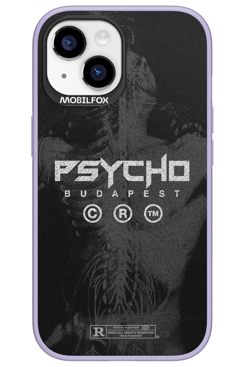 X-Ray - Apple iPhone 15