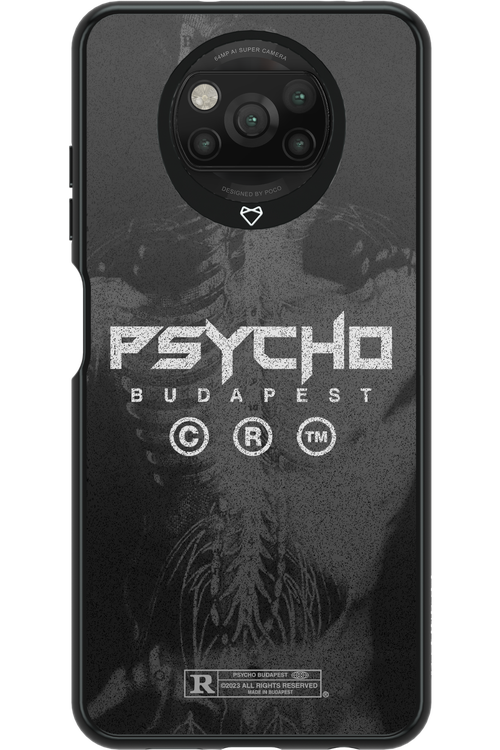 X-Ray - Xiaomi Poco X3 NFC