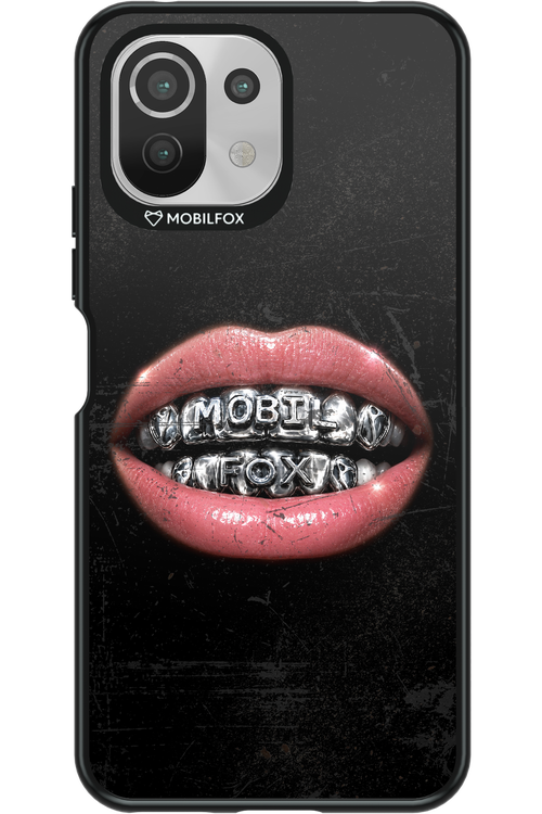 MOBILFOX GRILL 2.0 - Xiaomi Mi 11 Lite (2021)