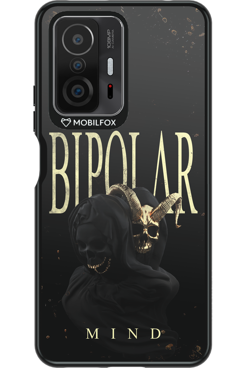 BIPOLAR 2.0 - Xiaomi Mi 11T
