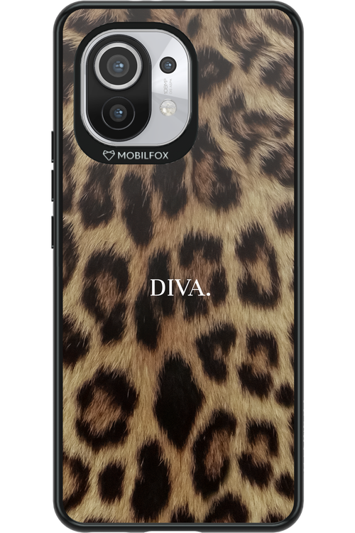 Diva - Xiaomi Mi 11 5G