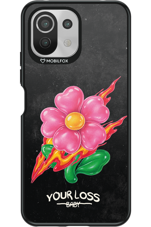 Your Loss 2.0 - Xiaomi Mi 11 Lite (2021)