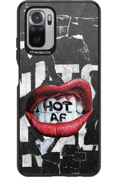 HOT AS F - Xiaomi Redmi Note 10