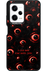 The Watchers - Xiaomi Redmi Note 12 Pro 5G