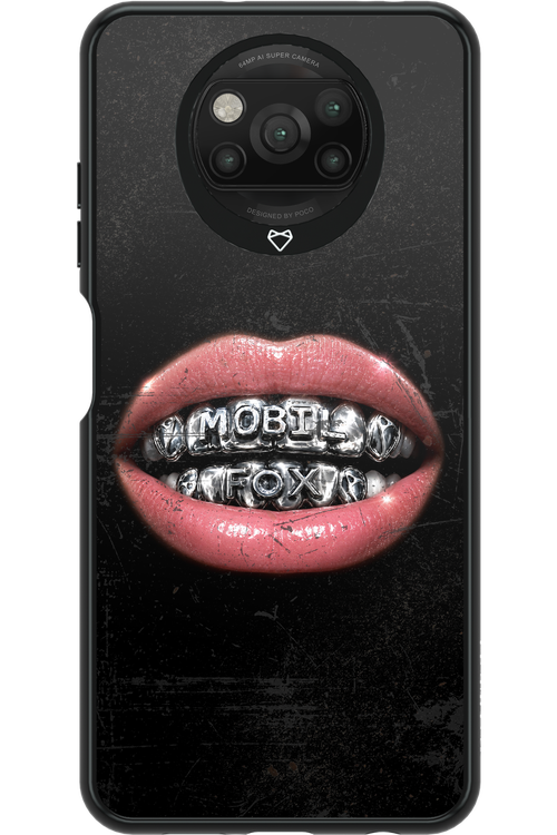 MOBILFOX GRILL 2.0 - Xiaomi Poco X3 NFC