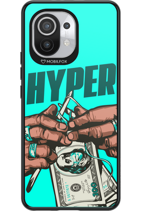 KNIT - Xiaomi Mi 11 5G