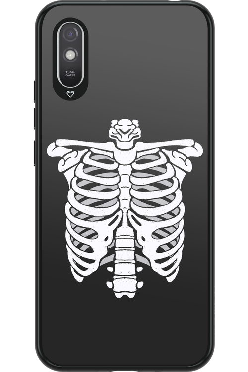 SKELETON - Xiaomi Redmi 9A