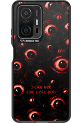 The Watchers - Xiaomi Mi 11T Pro