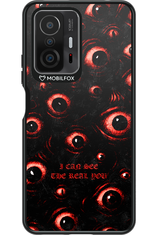 The Watchers - Xiaomi Mi 11T Pro