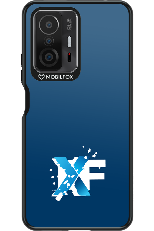 Nano Burst  - Xiaomi Mi 11T