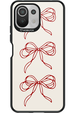 Bows - Xiaomi Mi 11 Lite (2021)
