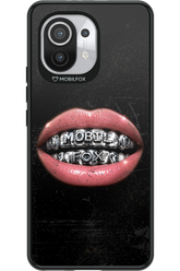 MOBILFOX GRILL 2.0 - Xiaomi Mi 11 5G