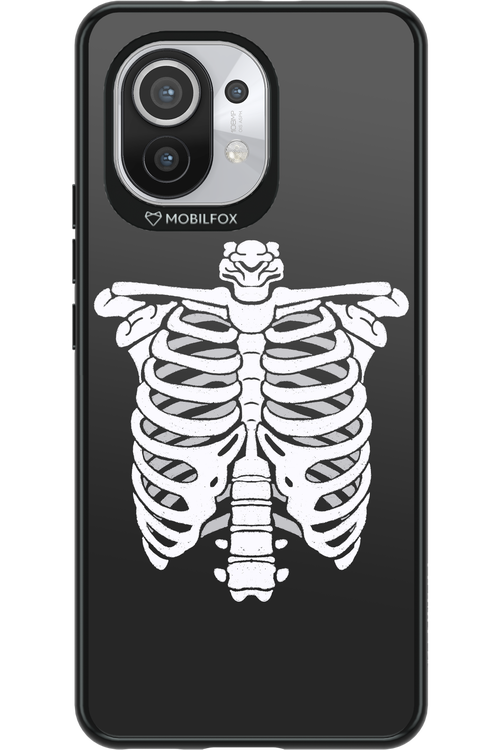 SKELETON - Xiaomi Mi 11 5G