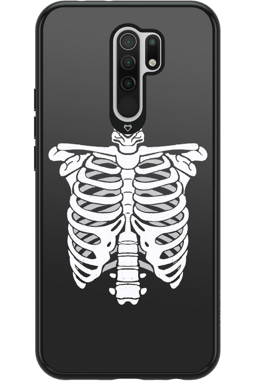 SKELETON - Xiaomi Redmi 9