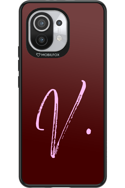 (Dark Blush) V 2.0 - Xiaomi Mi 11 5G