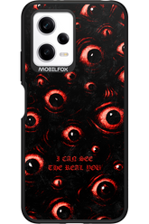 The Watchers - Xiaomi Redmi Note 12 5G