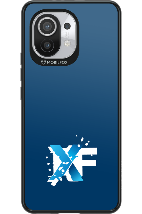 Nano Burst  - Xiaomi Mi 11 5G