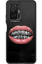 MOBILFOX GRILL 2.0 - Xiaomi Mi 11T