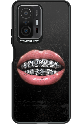 MOBILFOX GRILL 2.0 - Xiaomi Mi 11T