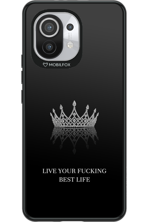 Lifestyle Queen 2.0 - Xiaomi Mi 11 5G
