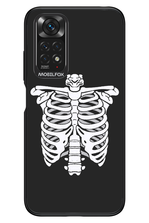 SKELETON - Xiaomi Redmi Note 11/11S 4G