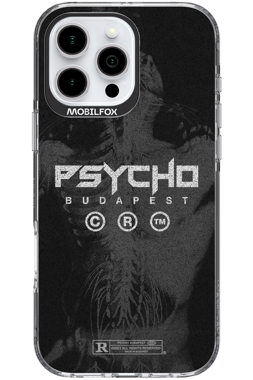 X-Ray - Apple iPhone 16 Pro Max