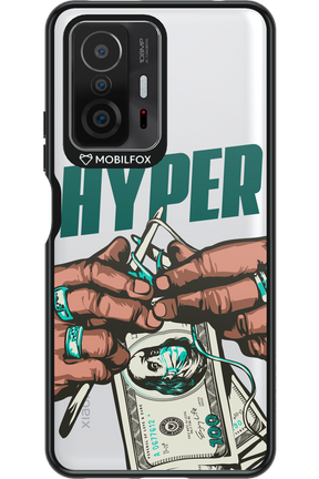 KNIT Transparent - Xiaomi Mi 11T